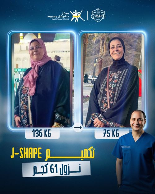 افضل دكتور تكميم معدة